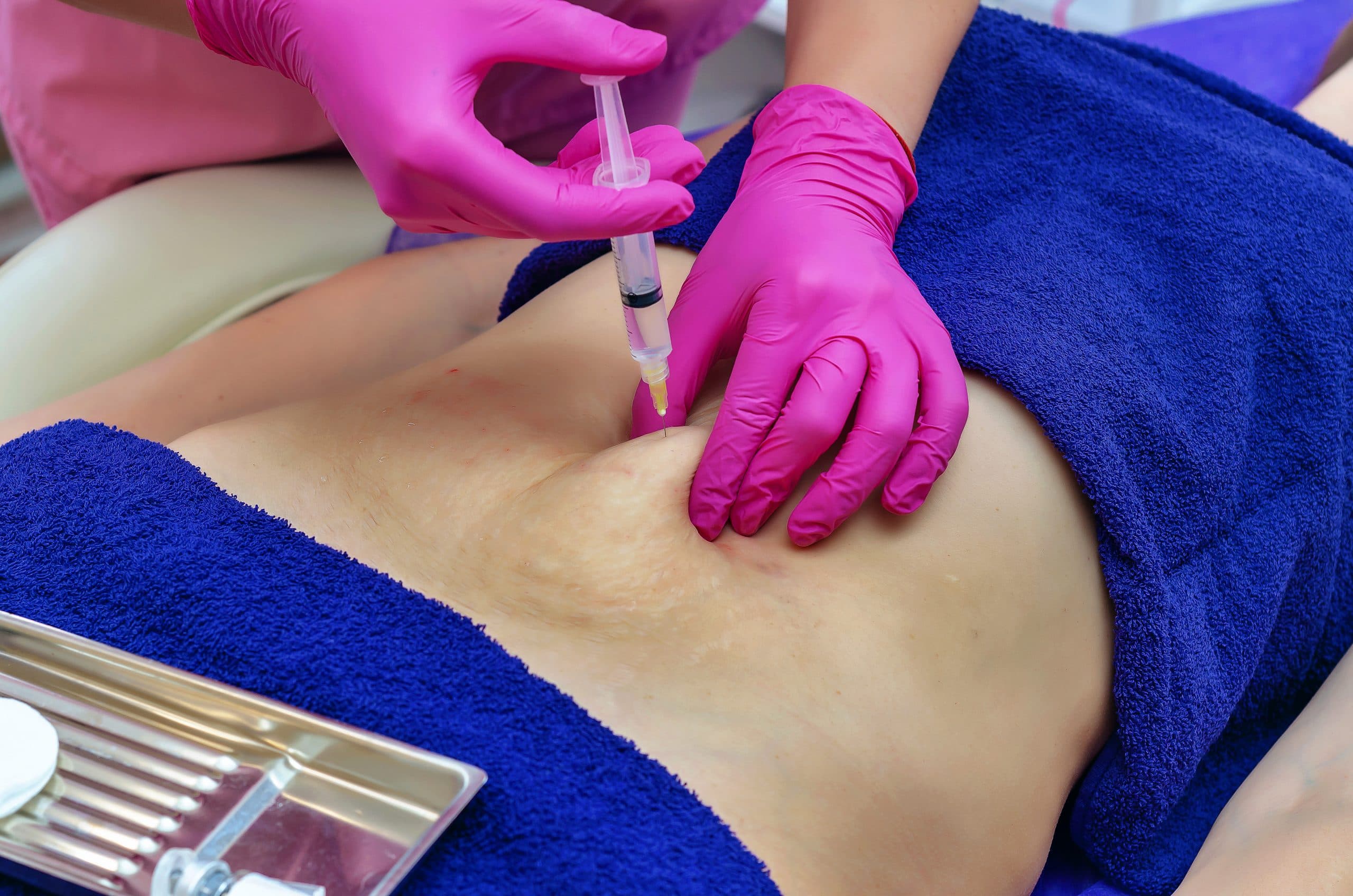 Fat Dissolving Injections Near Me